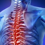 Medicamento para tratar atrofia espinhal muscular é incluído no SUS
