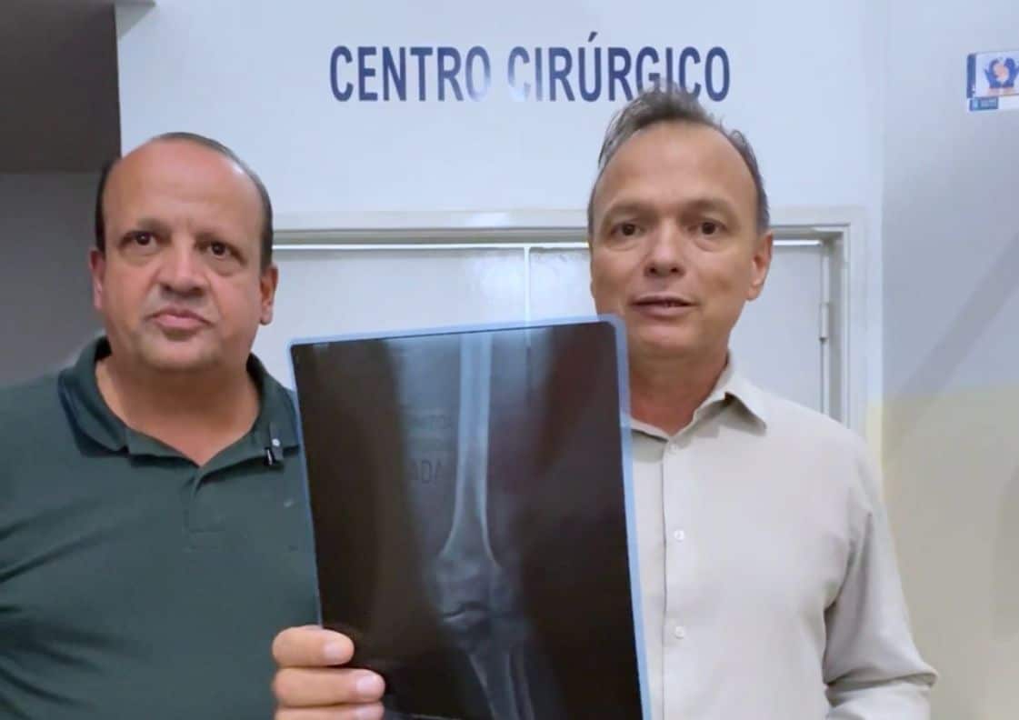 Caldas Novas: Hospital Municipal Dr. André Ala Filho realiza cirurgia ortopédica inédita na rede pública