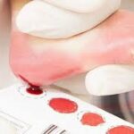 Câmara aprova ampliação do Teste do Pezinho