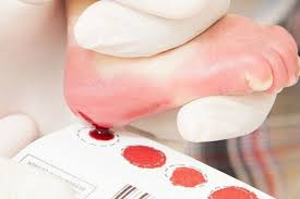 Câmara aprova ampliação do Teste do Pezinho