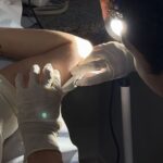 Aparecida passa a oferecer implante contraceptivo implanon na rede municipal de saúde