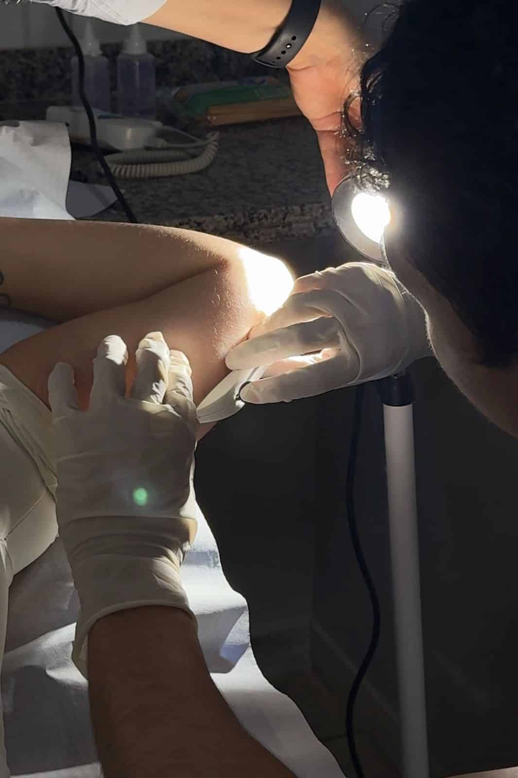 Aparecida passa a oferecer implante contraceptivo implanon na rede municipal de saúde